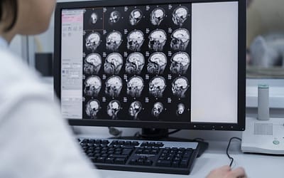 How Eye Tests Can Uncover Hidden Health Issues: From Brain Tumors to Neurological Conditions