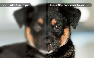 Presbyopia